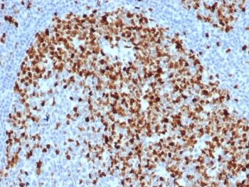 Topoisomerase II alpha Antibody / TOP2A