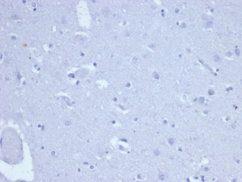 Topoisomerase II alpha Antibody / TOP2A