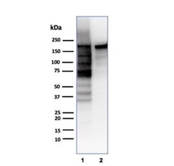 Topoisomerase II alpha Antibody / TOP2A