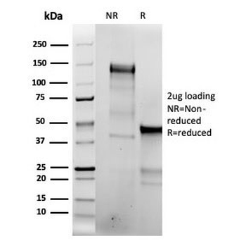 Topoisomerase II alpha Antibody / TOP2A