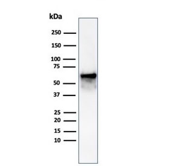 HSP60 Antibody