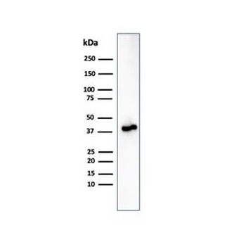 AMACR / p504S Antibody (Prostate Cancer Marker)