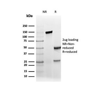 AMACR / p504S Antibody (Prostate Cancer Marker)