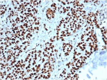 MSH2 Antibody
