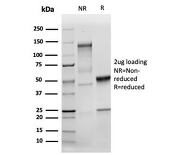 MSH2 Antibody