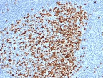 Topoisomerase II alpha Antibody / TOP2A