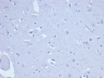 Topoisomerase II alpha Antibody / TOP2A