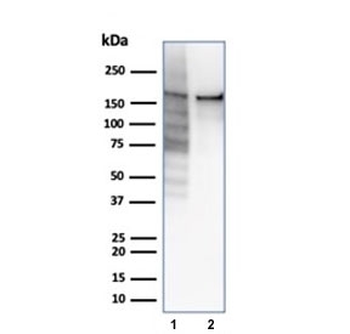 Topoisomerase II alpha Antibody / TOP2A