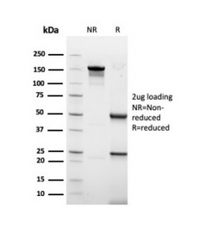 Acidic Cytokeratin Antibody (LMW / Type I)