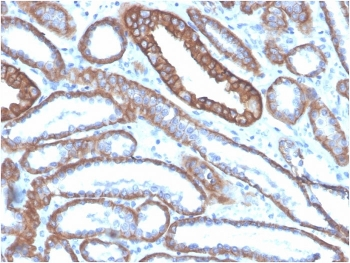 E-Cadherin Antibody / CDH1