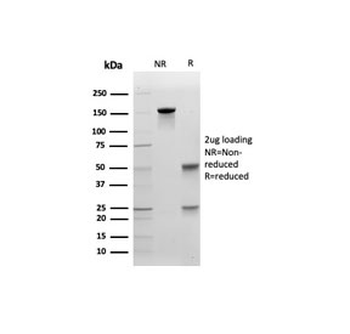 E-Cadherin Antibody / CDH1
