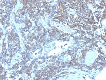 CD48 Antibody (Pan Leukocyte Marker)