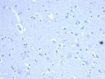 CD44 Antibody / HCAM