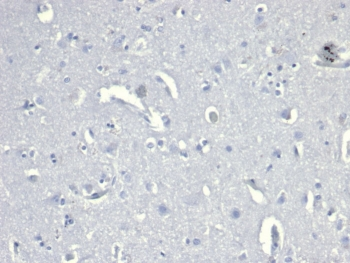 CD38 Antibody