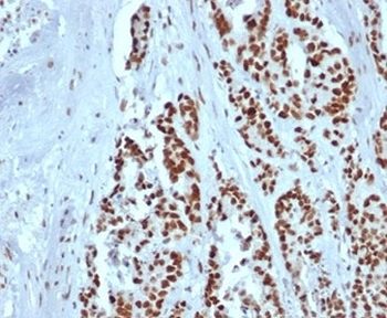 MSH2 Antibody