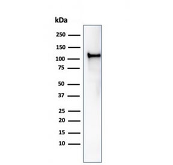 MSH2 Antibody