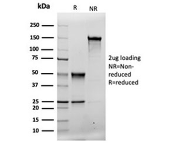 MSH2 Antibody
