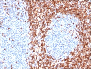 Recombinant Bcl-2 Antibody