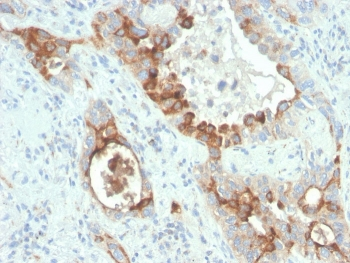 TMEPAI Antibody / PMEPA1