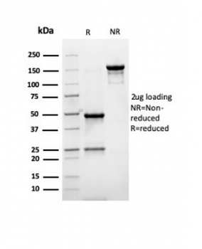 TMEPAI Antibody / PMEPA1