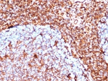 Vimentin Antibody