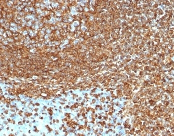 Vimentin Antibody