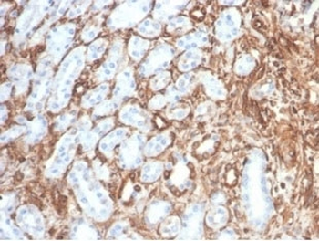Vimentin Antibody