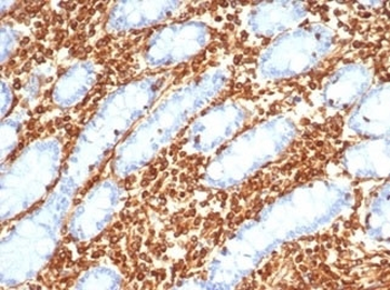 Vimentin Antibody