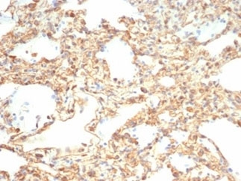 Vimentin Antibody