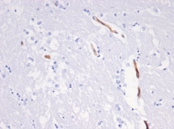 Vimentin Antibody