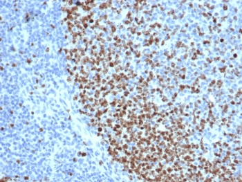Ki-67 Antibody