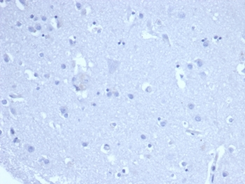 Ki-67 Antibody