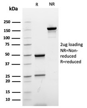Ki-67 Antibody