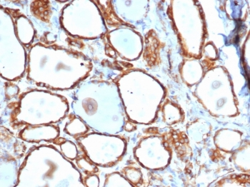 HSP27 Antibody / HSPB1
