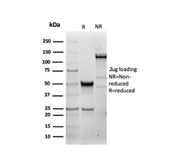 HSP27 Antibody / HSPB1