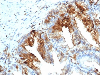 FABP5 Antibody