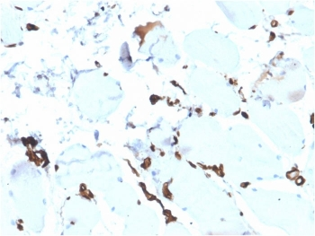 FABP5 Antibody
