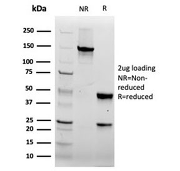 FABP5 Antibody