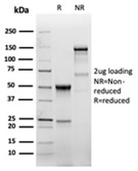 EGF Receptor / EGFR Antibody (Extracellular domain)