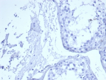 EGF Receptor / EGFR Antibody (Extracellular domain)