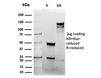 EGF Receptor / EGFR Antibody (Extracellular domain)