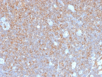 Gamma Parvin Antibody / PARVG