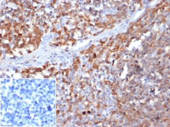 Gamma Parvin Antibody / PARVG