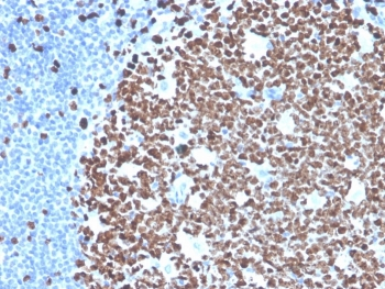 Ki-67 Antibody