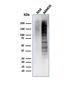 Ki-67 Antibody