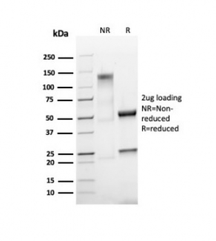 Ki-67 Antibody