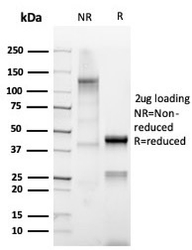 Mammaglobin A Antibody / SCGB2A2