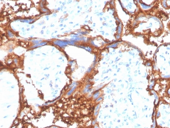 EGF Receptor / EGFR Antibody (C-terminal region)