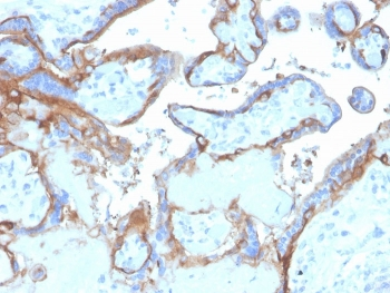 EGF Receptor / EGFR Antibody (C-terminal region)