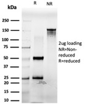 PDX1 Antibody / Pancreas/duodenum homeobox protein 1